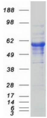 Coomassie blue staining of purified CD5 protein.
